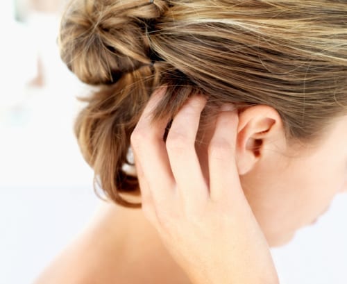 Understanding Dry Scalp, Dandruff + Seborrheic Dermatitis